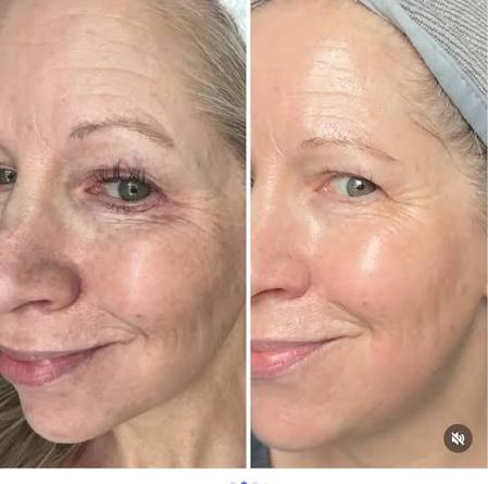 Anti-Wrinkle Retinol Cream 100 ml
