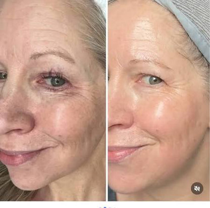 Anti-Wrinkle Retinol Cream 100 ml